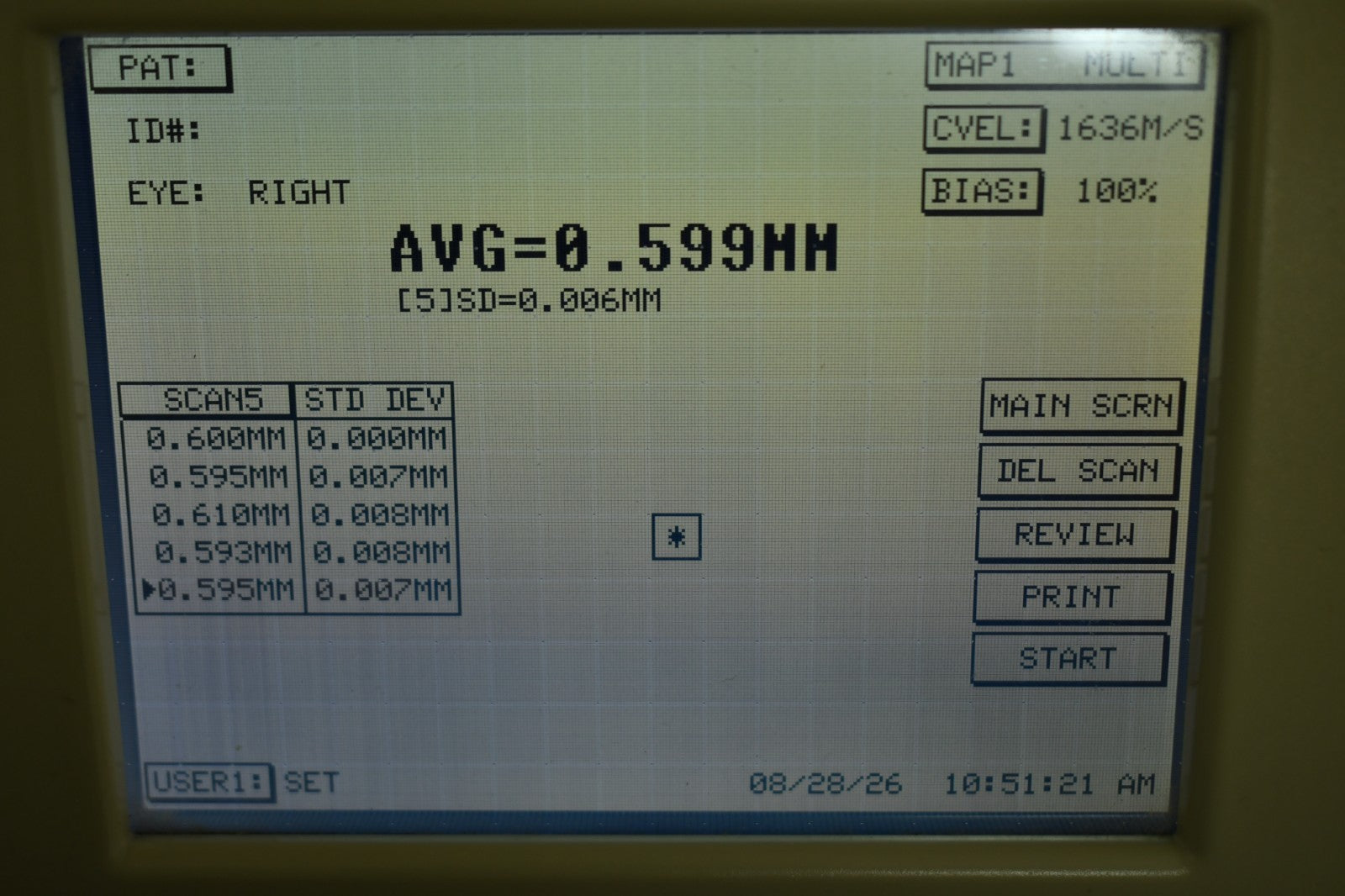 Sonomed PacScan 300AP probe