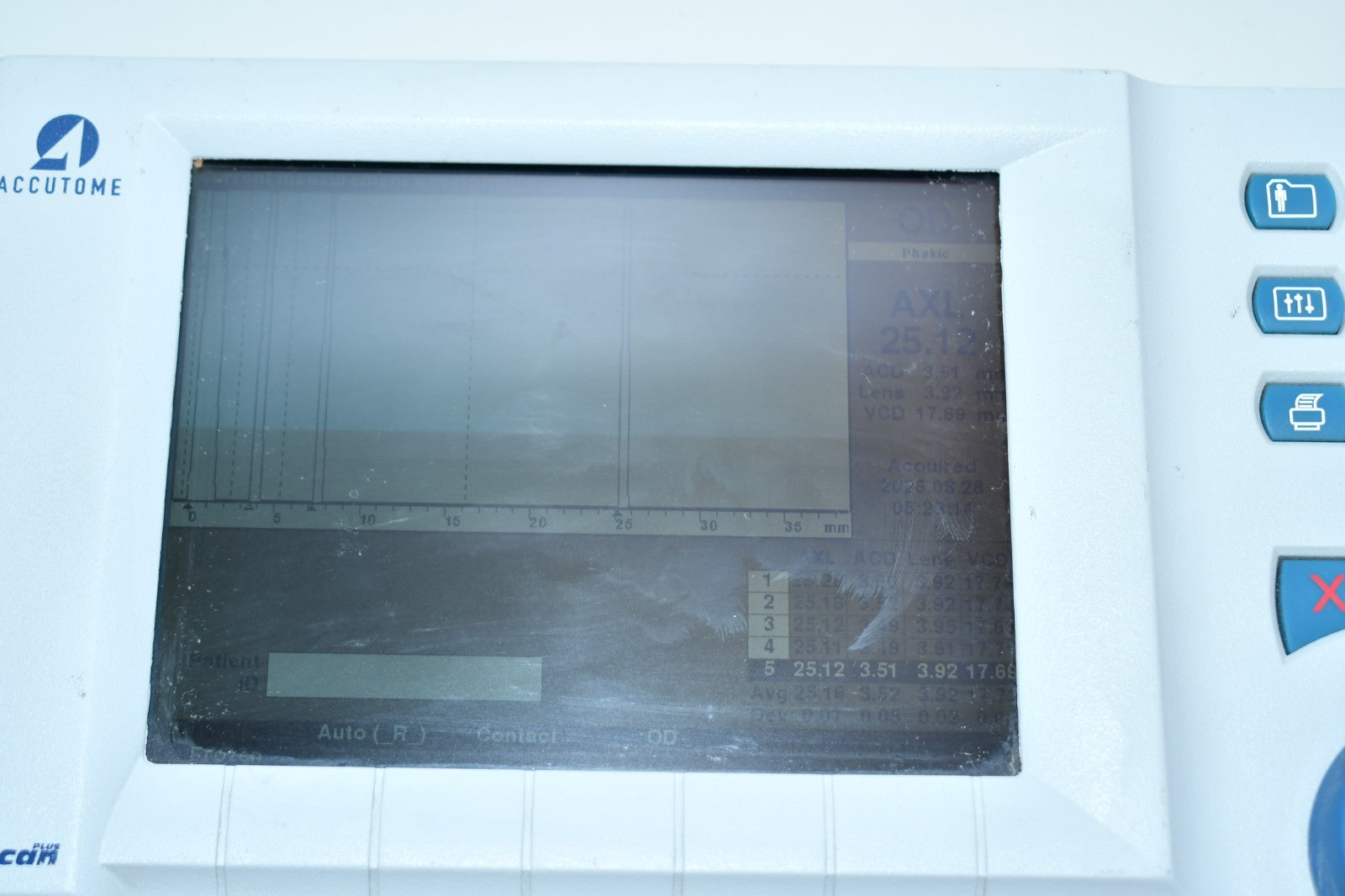 Accutome A-Scan Plus display