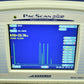 Sonomed PacScan Plus 300AP+ display