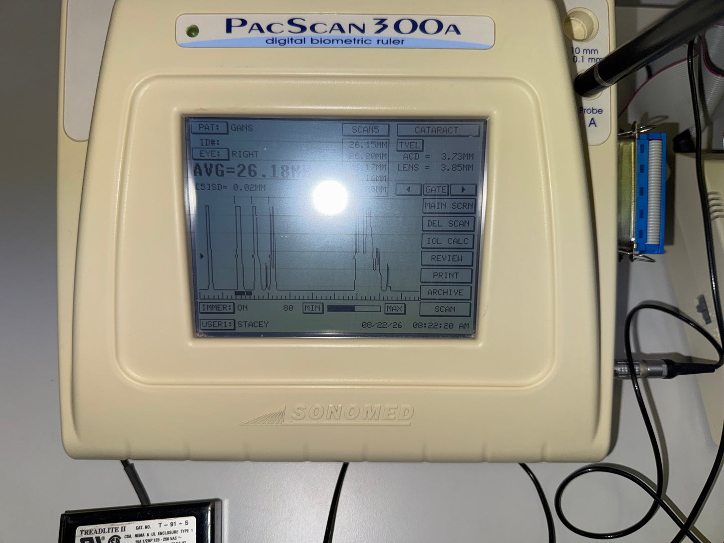Sonomed PacScan 300A A-Scan Biometer photo 3