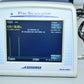 Sonomed PacScan Plus 300A+ photo 2
