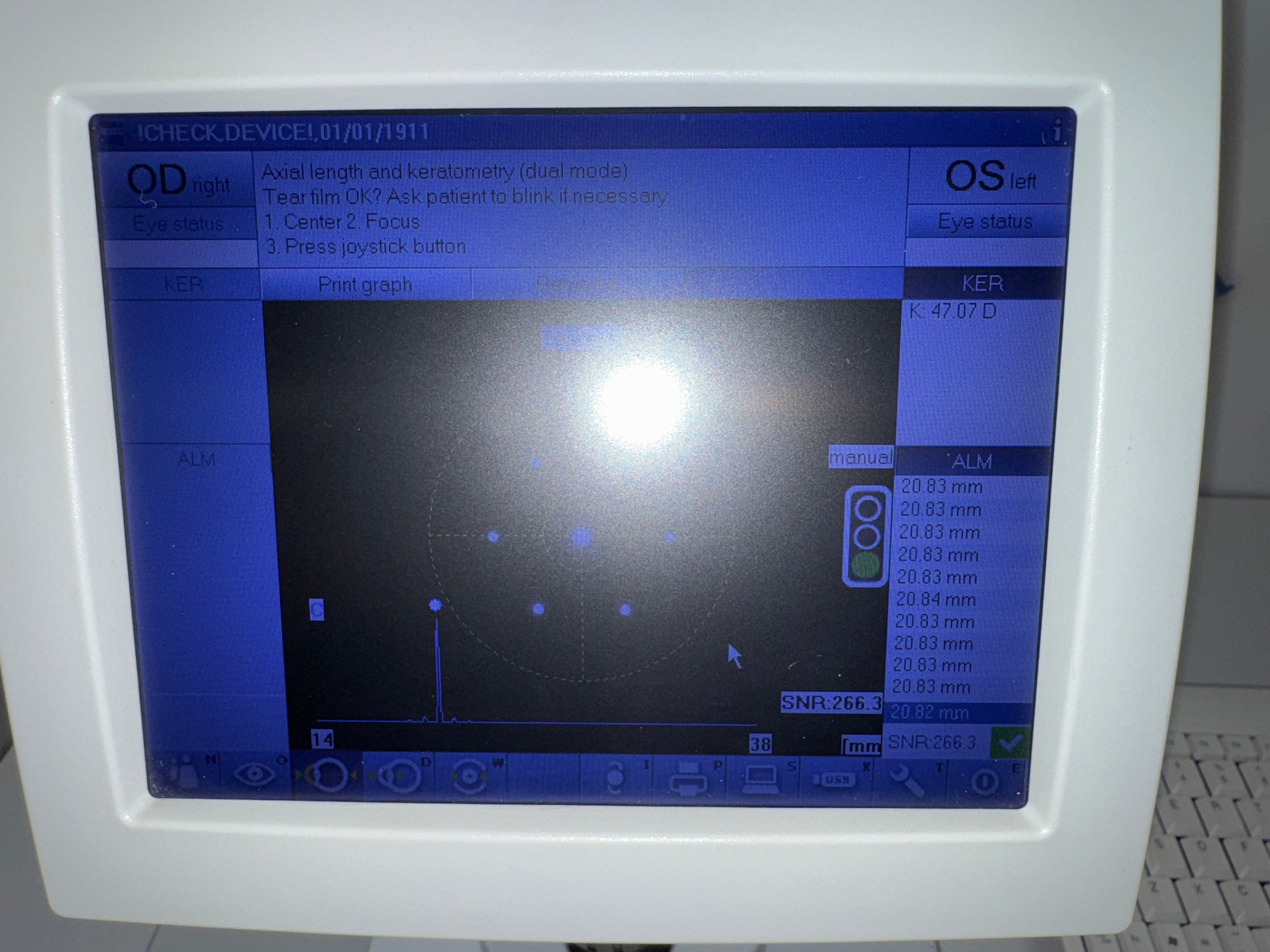 Carl Zeiss IOLMaster 500 Optical Biometer photo 2