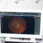 ZEISS Clarus 500 - photo 3