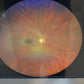 ZEISS Clarus 500 - photo 7