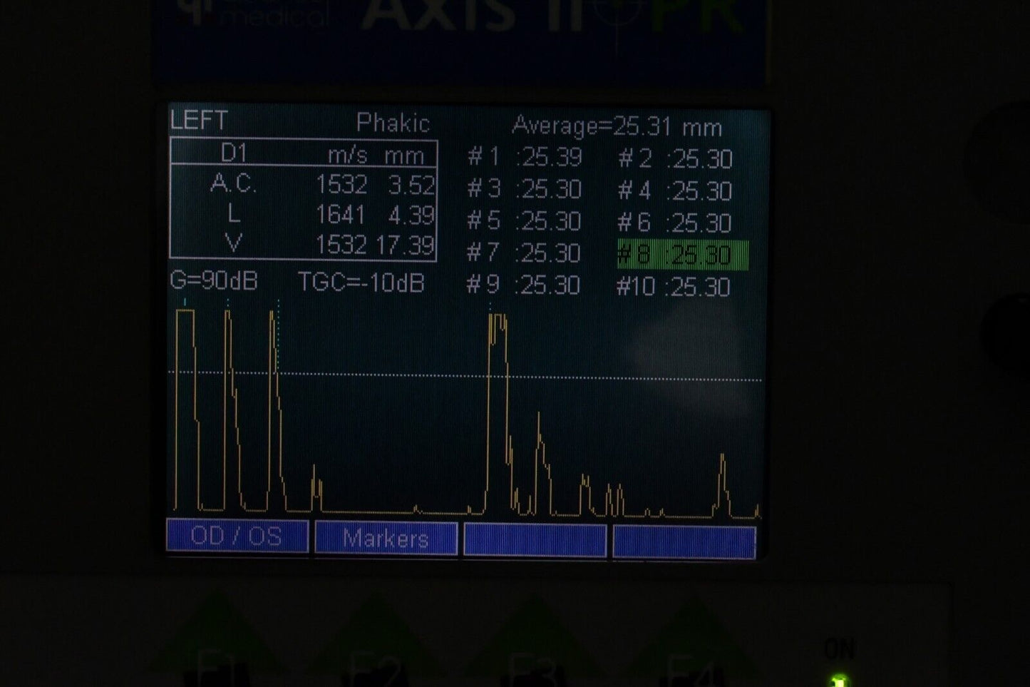 QUANTEL MEDICAL AXIS II PR Ultrasound A-Scan  Biometer
