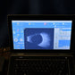 Quantel Medical Aviso B scan Ultrasound complete