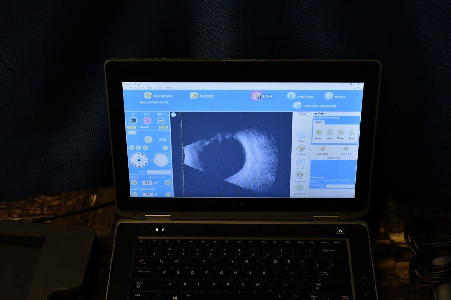 Quantel Medical Aviso B scan Ultrasound complete