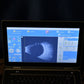 Quantel Medical Aviso B scan Ultrasound complete