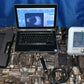 Quantel Medical Aviso B scan Ultrasound complete