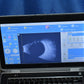 Quantel Medical Aviso B scan Ultrasound complete