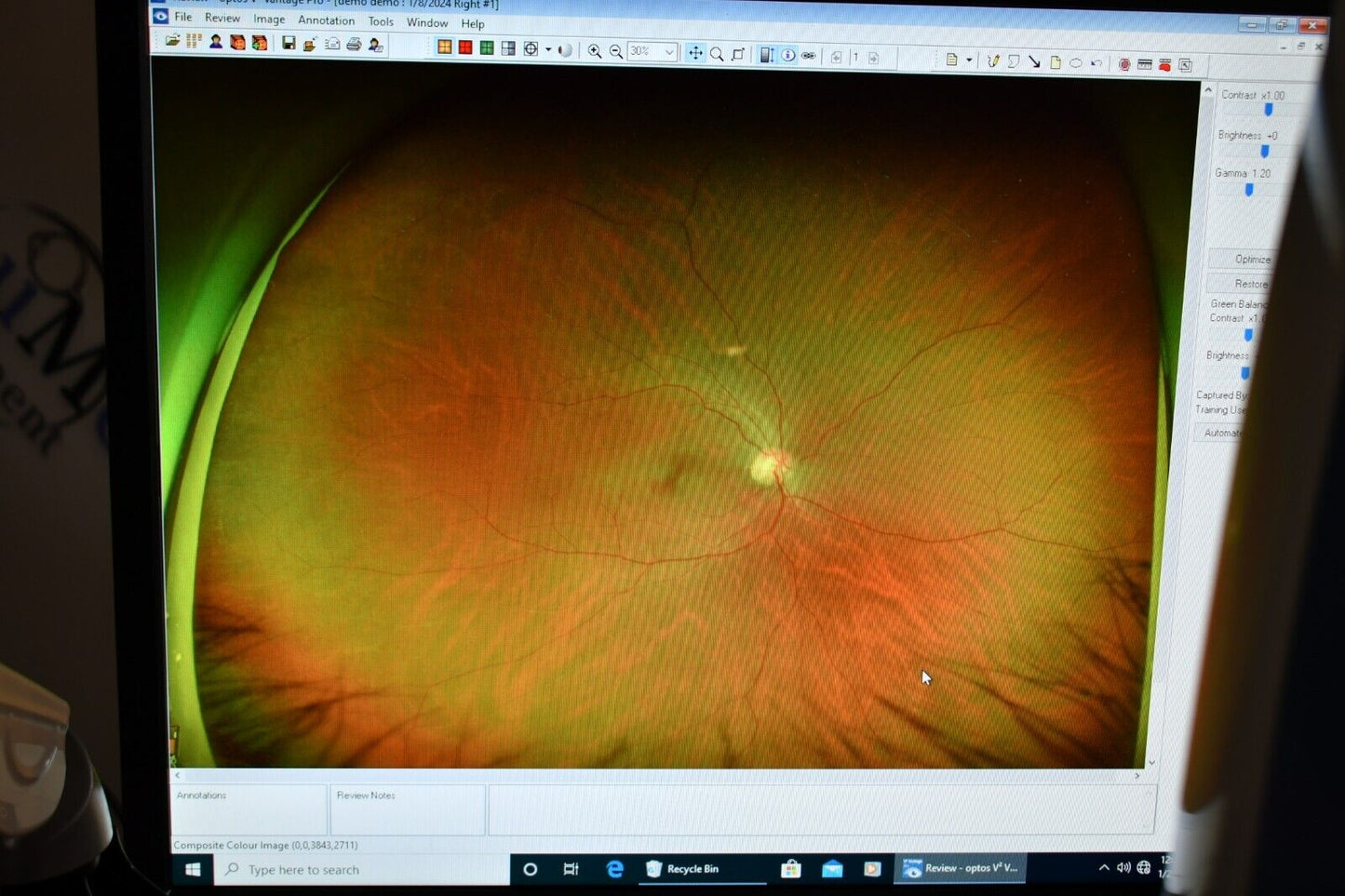 Optos California 2019 RG AF FFA ICG retinal Camera