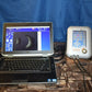 Quantel Aviso Bscan UBM ophthalmic ultrasound