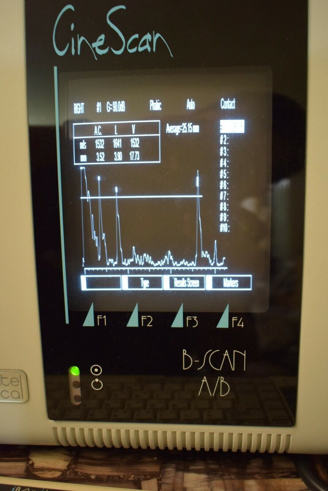 Quantel CineScan B-Scan A/B Scan Ophthalmic Ultrasound