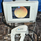 Nidek Handy NM-200D non-mydriatic Fundus Camera