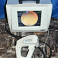 Nidek Handy NM-200D non-mydriatic Fundus Camera