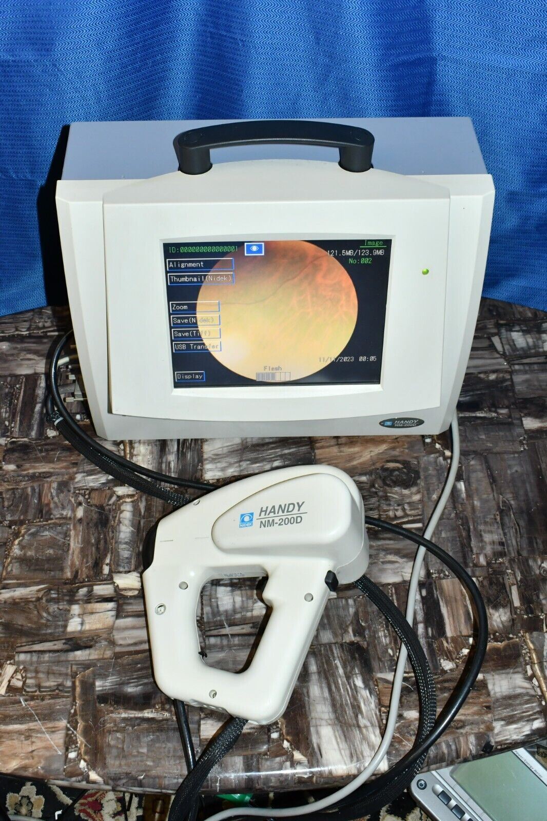 Nidek Handy NM-200D non-mydriatic Fundus Camera