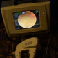 Nidek Handy NM-200D non-mydriatic Fundus Camera