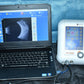 Quantel Medical Aviso A and B scan Ultrasound complete